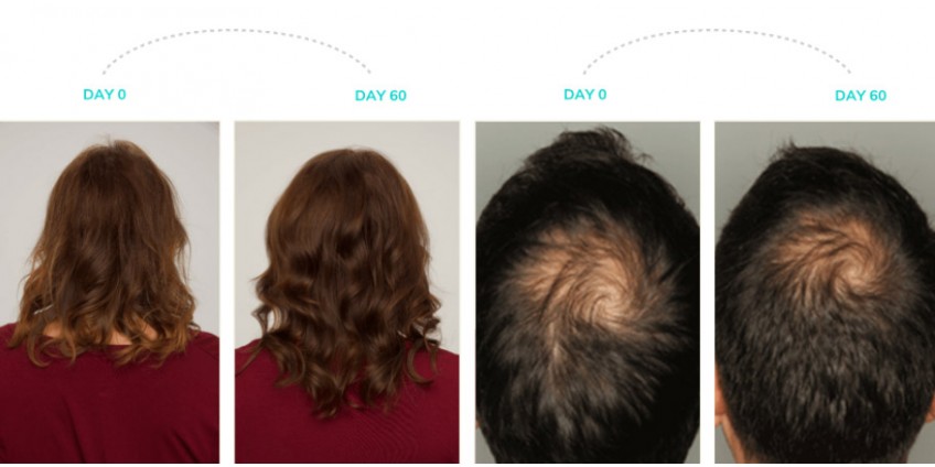 ¡Haz crecer tu cabello con confianza!
